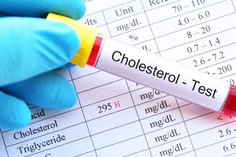 Kenali Kolesterol, Penyebab Dan Gejalanya